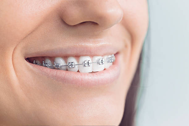Dental Inlays and Onlays in Sacramento, CA